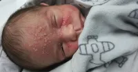O caso aconteceu em São Paulo com o Gustavo, filho da manicu...
